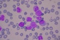 Immature and mature white blood cells