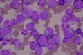 Immature and mature white blood cells