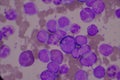 Immature and mature white blood cells