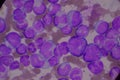 Immature and mature white blood cells