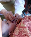 Immunization