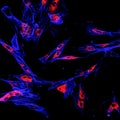 Immunofluorescence confocal imaging of a melanoma cancer cell line Royalty Free Stock Photo