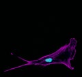 Immunofluorescence confocal imaging of a single invading metastatic prostate cancer cell sticking out protrusions with