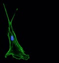 Immunofluorescence confocal imaging of a single invasive lung cancer cell Royalty Free Stock Photo