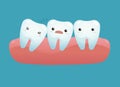 Impacted tooth Royalty Free Stock Photo