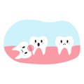 Impacted wisdom tooth in cartoon flat style. Vector illustration of disgruntled teeth characters, dental health concept, oral Royalty Free Stock Photo