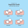 Impaction tooth illustration vector on blue background. Dental