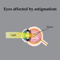 Impaired vision with astigmatism. As astigmatism Royalty Free Stock Photo