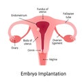 Implantation. stage of pregnancy when embryo adheres to the wall of the uterus. Parts of uterus are marked with lines Royalty Free Stock Photo