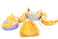 Implantation of teeth. Manufacturing of prosthetic teeth in a dental laboratory. Jaws with teeth on a white background.