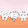 Implantation Tooth