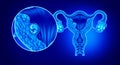 Implanted Embryo In The Uterus