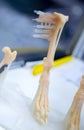 Implants and prostheses printed on 3D printer from biocompatible titanium powder Royalty Free Stock Photo