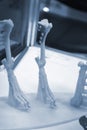 Implants and prostheses printed on 3D printer from biocompatible titanium powder Royalty Free Stock Photo
