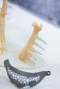 Implants and prostheses printed on 3D printer from biocompatible titanium powder Royalty Free Stock Photo