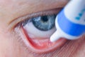 Instill eyedrops or ointment on eye