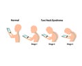 Improper posture symptoms. Stage Text Neck Syndrome. Spinal curvature, kyphosis, lordosis, scoliosis, arthrosis