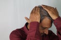 Indian man showing his white hair and hair loss problem at a young age Royalty Free Stock Photo