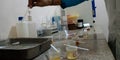 indian village hospital laboratory setup kept urine sample for testing in india aug 2019 Royalty Free Stock Photo