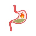 From Acid Reflux or Heartburn and Gastritis. Indigestion and stomachache problems concept. Isolated vector illustration