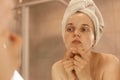 Indoor shoot of young adult beautiful woman wearing bath towel standing in bathroom and looking for or squeezing acne on chin, Royalty Free Stock Photo