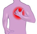 Infarct medical illustration