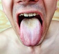 Infection tongue