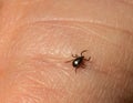 Infectious Encephalitis Ixodes Scapularis or Persulcatus Deer Tick Insect on Skin. Encephalitis Virus or Lyme Royalty Free Stock Photo