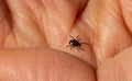 Infectious Encephalitis Ixodes Scapularis or Persulcatus Deer Tick Insect on Skin. Encephalitis Virus or Lyme Royalty Free Stock Photo