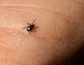 Infectious Encephalitis Ixodes Scapularis or Persulcatus Deer Tick Insect on Skin. Encephalitis Virus or Lyme Royalty Free Stock Photo