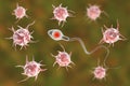 Infertility concept, microbes attacking spermatozoon and preventing it from fertilization