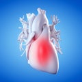 An inflamed heart Royalty Free Stock Photo
