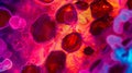inflamed human lymph node under a microscope, inflamed tonsils, lymph node problem