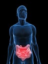 Inflamed intestines Royalty Free Stock Photo