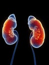 Inflamed kidneys Royalty Free Stock Photo