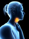 inflamed larynx