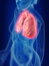 An inflamed lung Royalty Free Stock Photo