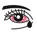 Inflammated eye Conjunctivitis or pink eye Royalty Free Stock Photo