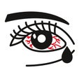 Inflammated eye Conjunctivitis or pink eye Royalty Free Stock Photo