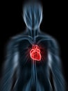 Inflammated heart Royalty Free Stock Photo