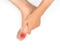 Inflammation of Asian young manÃ¢â¬â¢s big toe. Concept of foot joint pain, arthritis, hyperuricema or gout Royalty Free Stock Photo