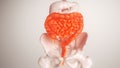 Inflammation of the digestive tract - 3D rendering