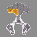 Inflammation of frontal cavity, or frontitis. Localized rhinosinusitis