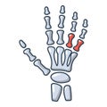 Inflammation of hand icon, cartoon style. Royalty Free Stock Photo