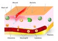 Inflammation. innate immune system Royalty Free Stock Photo