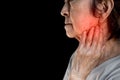 Inflammation at the jaw of Asian patient. She feels wisdom toothache and lymph node pain