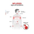 Influenza. Signs and symptoms