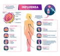 Influenza vector illustration. Labeled flu symptoms and complication scheme