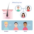 Infographic of gray hair vector on white background.