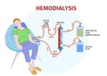 Infographic of hemodialysis, a procedure where a dialysis machine are used to clean blood